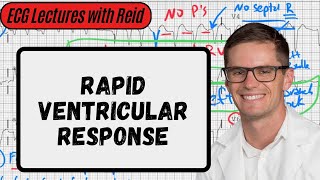 Atrial Fibrillation w RVR  Day 14 ECG Challenge [upl. by Yajiv]