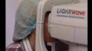 LASIK WaveFront Custom Eye Surgery IQ Laser Vision [upl. by Zondra]