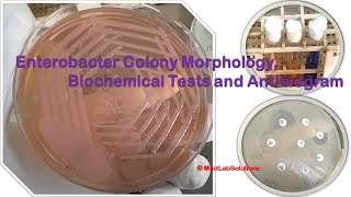 Enterobacter Colony Morphology Biochemical Tests and Antibiogram Demonstration [upl. by Ahseia]