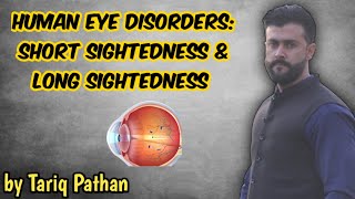 Human Eye Disorders Short Sightedness amp Long Sightedness  Tariq Pathan [upl. by Mcclenaghan]