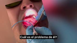 Somnoplastia Laser en paciente roncador [upl. by Peterec118]