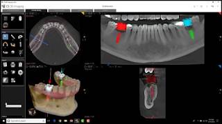 Carestream 3D Imaging  Cross Section Tool [upl. by Elder]