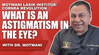 What is Astigmatism in the Eye [upl. by Ellevart783]