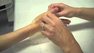 How to fabricate a short thumb opponens splint [upl. by Rebmit]