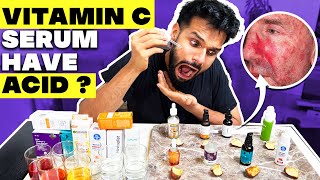 Testing The Best Vitamin C Serum For Indian Skin Shocking Result  BeYourBest Skincare San Kalra​ [upl. by Cloris]