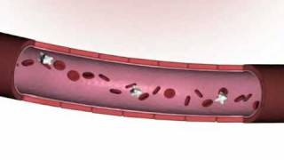 Modulación de la Inflamación con Fibroquel [upl. by Parthinia]