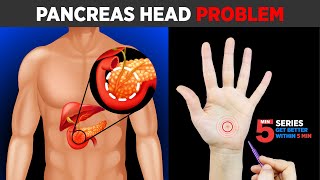 SUJOK TREATMENT FOR Pancreas Head Problem😖🔥ON LEFT HAND [upl. by Alyam]