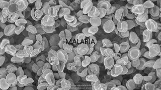 Malaria SINTOMATOLOGÍA notas de estudio [upl. by Atiuqan]