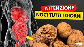 Dibattito chiuso le NOCI sono la miglior frutta secca al mondo [upl. by Wixted]