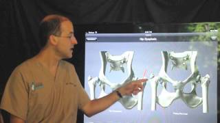 Femoral head and neck ostectomy FHO in the dog and cat [upl. by Oremodlab]