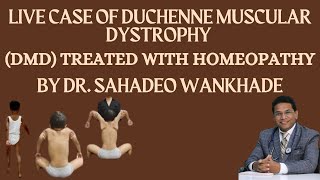 quotLive Case of Duchenne Muscular Dystrophy DMD Treated with Homeopathy BY DR SAHADEO WANKHADE [upl. by Aniale948]