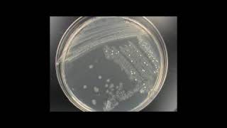 Identification of Unknown Bacteria [upl. by Rusell]