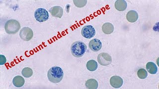 Reticulocyte  Reticulocyte count test in hindi [upl. by Nashbar]