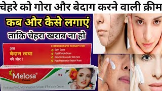 Melosa Cream Review in Hindi  चेहरे को गोरा बनाने वाली क्रीम  Melosa Cream  Face whitening cream [upl. by Dlonra]