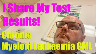 CML Chronic Myeloid Leukaemia  My Test Results Shared [upl. by Ytsirk]