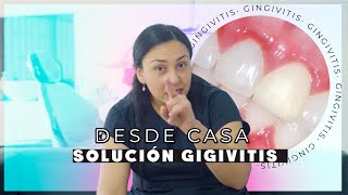 Gingivitis Tratamiento casero  Causas y soluciones [upl. by Inanaup622]