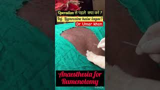 Rumenotomy l Bloat l Tympani l dr Umar khan [upl. by Barnebas145]