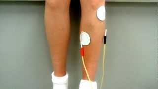 Tibialis Anterior Placement Correct One [upl. by Ahsakal]