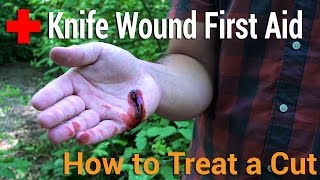 How to Treat a Cut  Knife Wound First Aid [upl. by Attenor984]