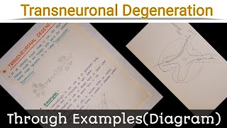 Transneuronal Degeneration [upl. by Hanselka]