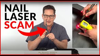 Nail Laser Scams DIY  Home Fungus Toenail Lasers  Do They Really Work [upl. by Eeliak30]