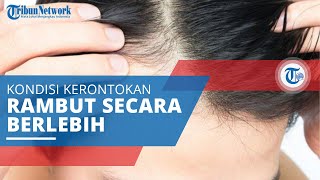 Kebotakan Kondisi Kerontokan Rambut yang Parah Sebabkan Adanya Bagian Pitak di Kulit Kepala [upl. by Ehttam]