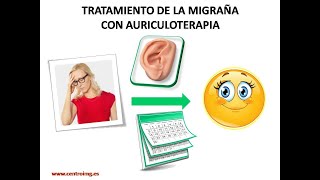 61 Tratamiento de la migraña con auriculoterapia Centro IMG [upl. by Garcia753]