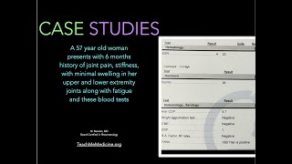 Case Studies A 57 year old woman seen with an ANA of 180 [upl. by Demmy775]