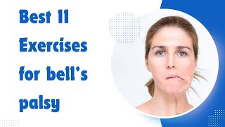 11 Best Exercises for Bells palsy [upl. by Rehportsirhc]