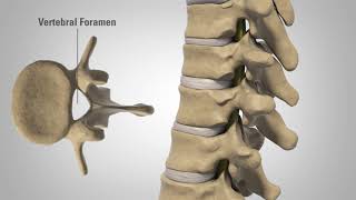 Myelopathy  Patient Education [upl. by Attennhoj]