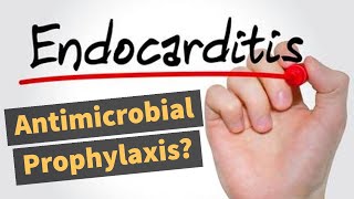 The controversy regarding PROPHYLAXIS for INFECTIVE ENDOCARDITIS in Dental Treatments  FAQ [upl. by Kentiggerma]