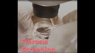 Cystic Fibrosis Screening [upl. by Ennoirb]