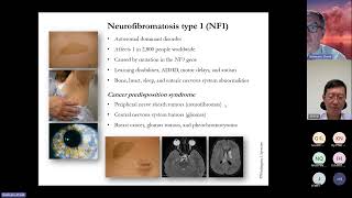 20241016 Neurofibromatosis [upl. by Crespo]