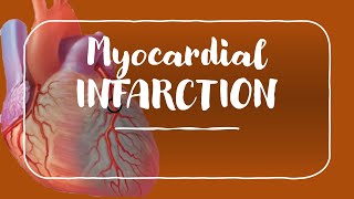 Myocardial Infarction and Angina for USMLE Step 1 and USMLE Step 2 [upl. by Trilbi]