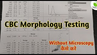 RBC morphology reporting [upl. by Isabel998]