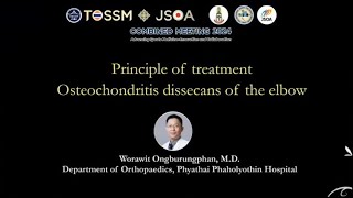 Osteochondritis dissecans of the elbow  principle of treatment [upl. by Atekal181]