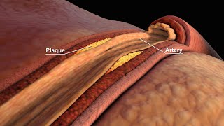 LDL and HDL Cholesterol  Good and Bad Cholesterol  Nucleus Health [upl. by Lewin]