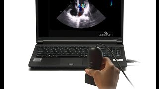 Ultrasound Video Challenge  Cardiography [upl. by Seidel]