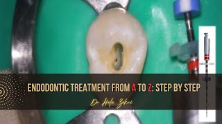 Root canal treatment from A to Z Step by Step [upl. by Yclehc]