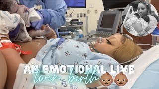 THE LIVE BIRTH OF OUR SECOND SET OF TWINS  Real Raw amp Emotional Doctor Turns Breech Baby in Womb [upl. by Syhr]