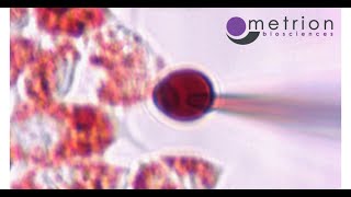 Demonstration of EndoLysosomal Patch Clamp Technique [upl. by Nelrsa]