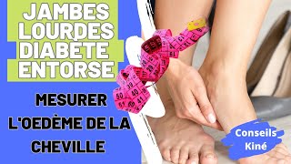 Suivi JAMBES LOURDES – DIABETE  ENTORSE Comment mesurer l’œdème de cheville [upl. by Slade]