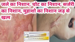 contractubex gel का use चोट निशान जले का निशान ओर किसी भी प्रकार के निशान को जड़ से खत्म [upl. by Lrigybab]