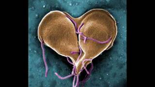 Infectious Disease InfoVid  Giardia [upl. by Jacqueline632]