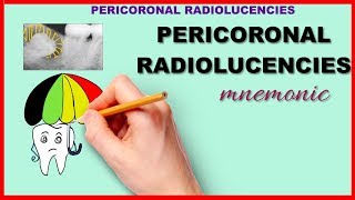 Pericoronal Radiolucency Mnemonic Series 20 [upl. by Ramalahs]