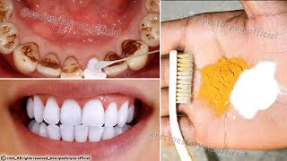 Secret that Dentists dont want you to know Remove Tartar and Teeth Whitening in just 2 minutes [upl. by Anirat]