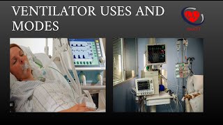 Mechanical Ventilator  Types Modes and Uses [upl. by Johannes112]