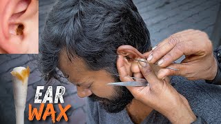 Wax Removal Inside Ear  Dirtiest Ear Cleaning on Street  Indian Street Ear Cleaner [upl. by Faulkner]