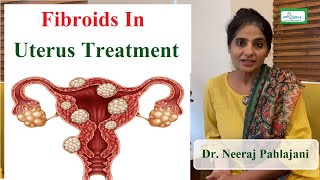 बच्चेदानी में गठान के लक्षण और ऑपरेशन करे या नहीं  Fibroid In Pregnancy [upl. by Teeter]