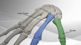 Thumb Metacarpal Arthritis Repair with Arthrex® CMC Mini TightRope® [upl. by Nosde]